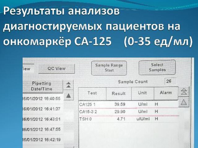 Онкомаркер СА-125: нормы и расшифровка анализов у женщин