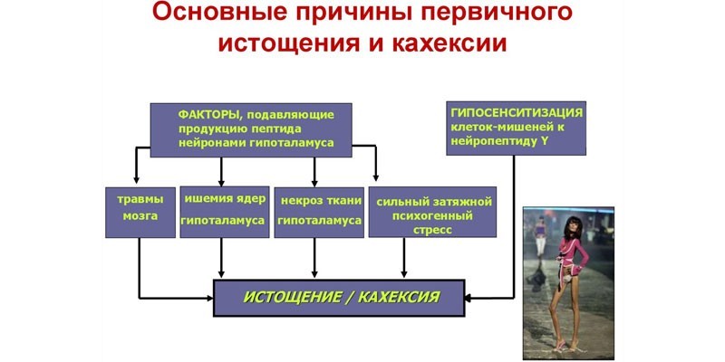 Раковая кахексия: что это такое, симптомы и степени развития истощения, методы лечения и прогноз выживаемости