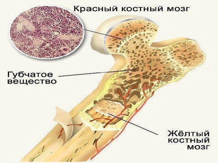 Рак костного мозга: виды и стадии заболевания, причины рака костного мозга, возможное лечение и прогнозы выживаемости