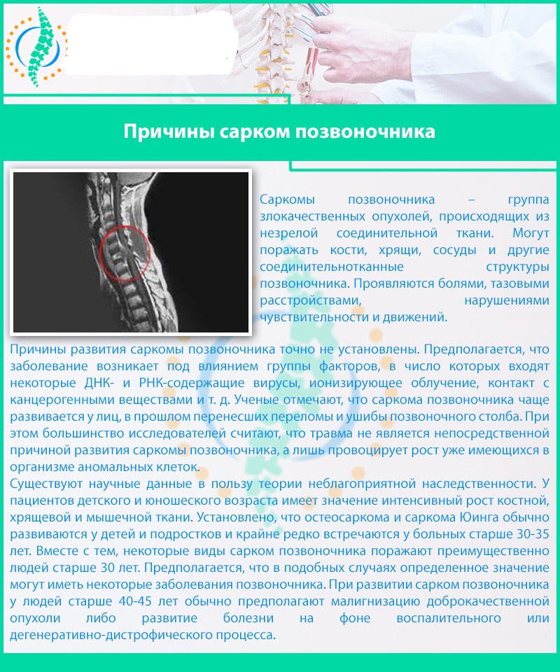 Саркома позвоночника: описание, симптомы и виды диагностики патологии, способы лечения и шансы на излечение