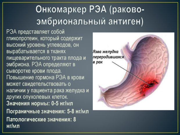 Онкомаркер РЭА: нормы и расшифровка ракового эмбрионального антигена - что означает и показывает