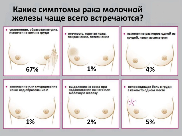 Рак по-женски: список женских онкологических заболеваний и полное описание, симптомы и факторы риска, прогноз для жизни