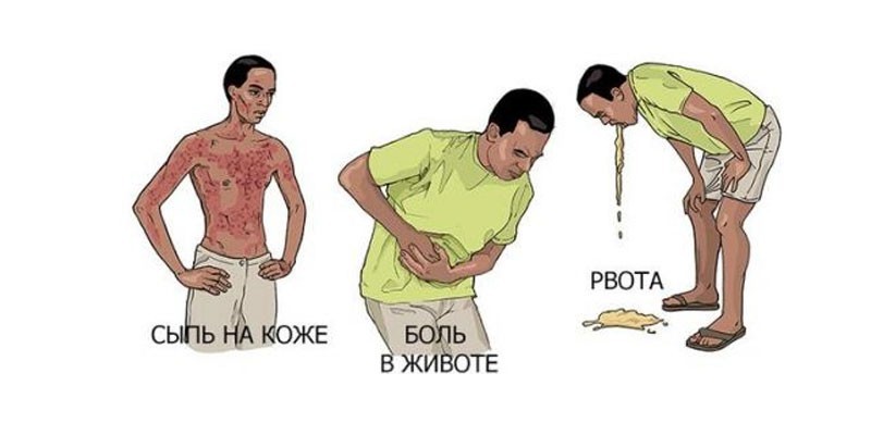 Рак тонкого кишечника: симптомы и проявление заболевания, виды и стадии болезни, примеры лечения и отзывы пациентов