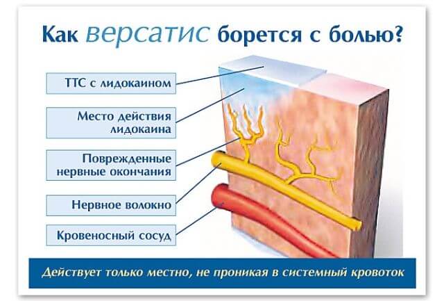 Обезболивание при онкологии: виды препаратов разной направлености для снятия болевого синдрома, список медикаментов, использование народной медицины как дополнение к медикаментозному лечению