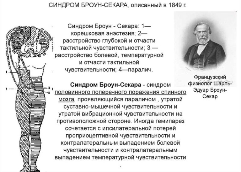 Рак спинного мозга: симптомы и признаки заболевания, диагностика, методы лечения и долгосточный прогноз
