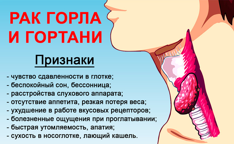 Рак шеи: признаки и симптомы, лечение злокачественных опухолей, диагностика заболевания и факторы риска