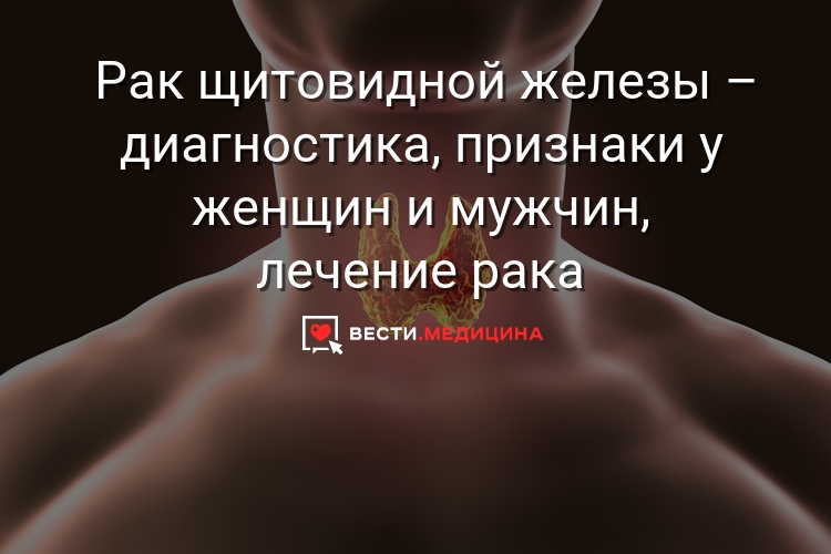 Рак щитовидной железы: признаки опухоли и возможный прогноз, причины возникновения заболевания, виды и стадии развития болезни, методы лечения