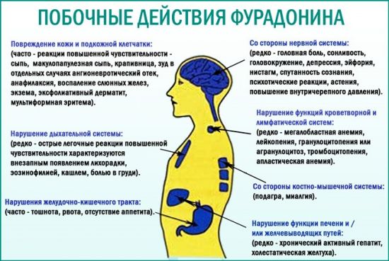 Фурадонин при простатите: состав, показания и противопоказания, особенности применения