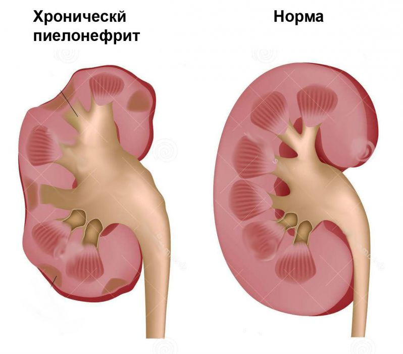 Лекарства от почек: таблетки, список препаратов и их названия