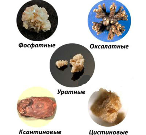 Пшено для лечения почек: старинный рецепт, отзывы, противопоказания
