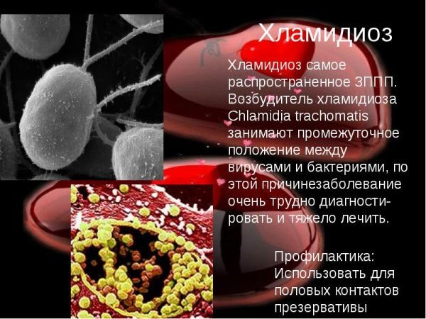 Хламидийный простатит: лечение хламидий, причины и симптомы, диагностика