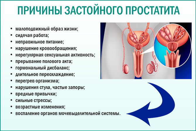 Хронический простатит: симптомы и лечение у мужчин, что это такое, признаки ремиссии, прогноз