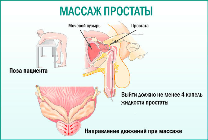 Простатит: симптомы и лечение у мужчин, что это такое, первые признаки, чем лечить