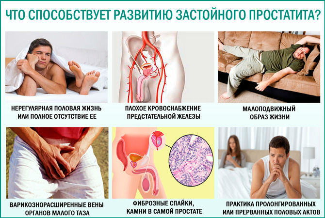 Застойный простатит у мужчин: лечение, симптомы, как лечить хроническую форму