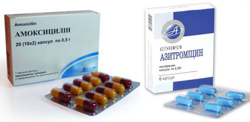 Антибиотики при цистите для лечения мужчин, женщин и детей