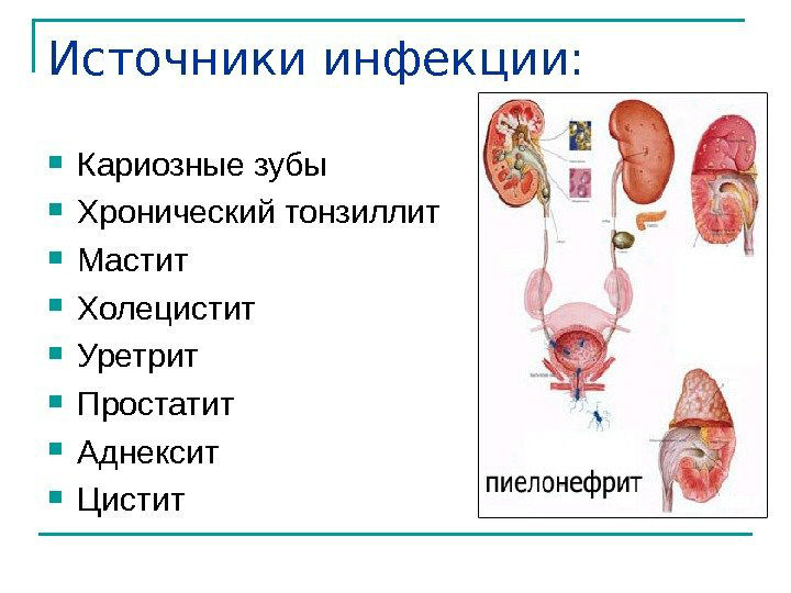 Воспаление уретры у женщин и мужчин: симптомы, лечение таблетками и препаратами
