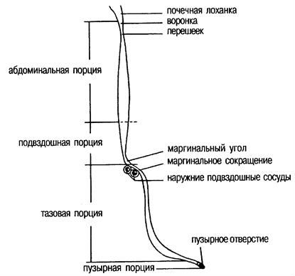 Сужение мочеточника: лечение и бужирование, диагностика