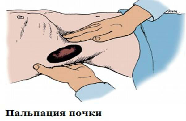 Абсцесс почки: симптомы, лечение и методы диагностики