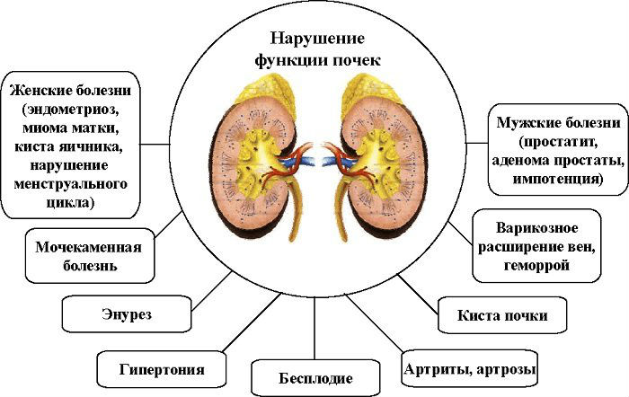 Болезни почек: симптомы и признаки, лечение, причины, список заболеваний