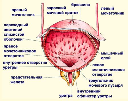 Утолщение стенок мочевого пузыря: причины, лечение у мужчин и женщин