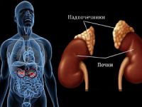 Миелолипома надпочечника, что это за объемное образование