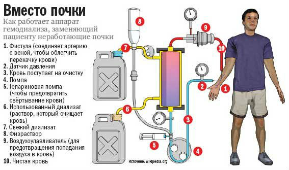 Сморщенная почка: что такое первичное и вторичное сморщивание, причины усыхания