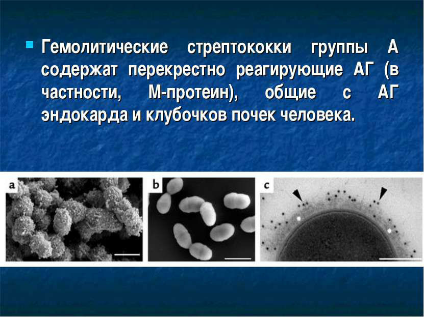 Хронический гломерулонефрит: симптомы и лечение, диета