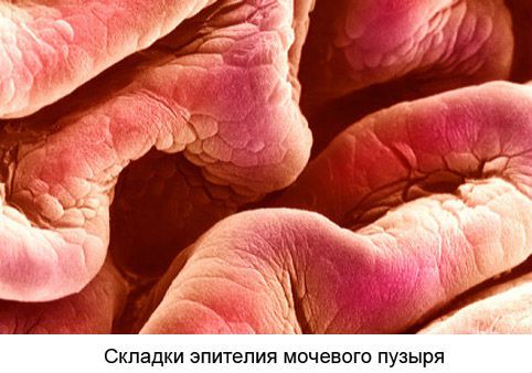 Болезни мочевого пузыря у женщин: симптомы, лечение заболеваний, признаки