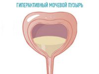 Нейрогенный мочевой пузырь у детей: лечение, симптомы