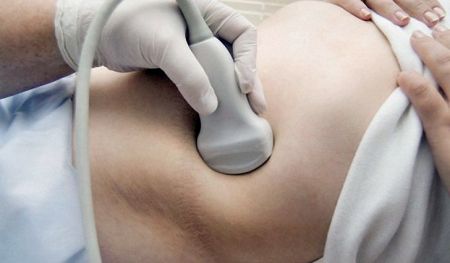 Почему болят почки по утрам после сна: основные причины боли