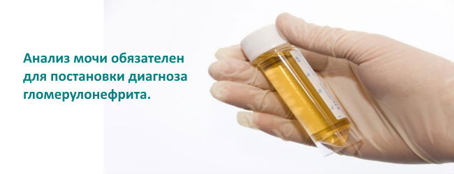 Гломерулонефрит: симптомы и лечение, что это такое, профилактика