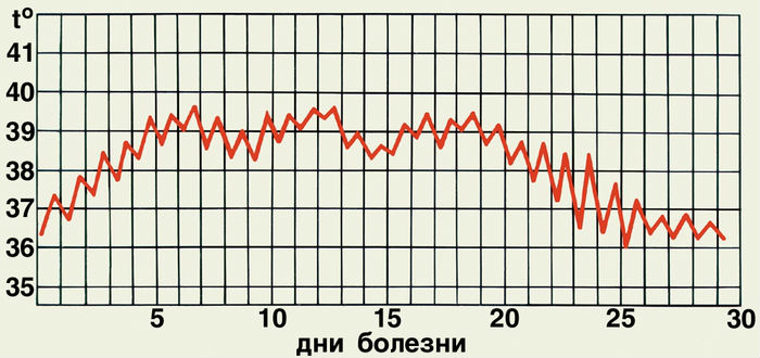 Температура при пиелонефрите и может ли быть болезнь без нее