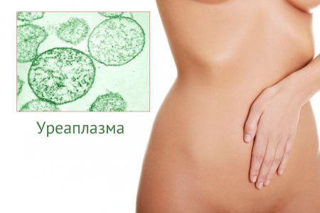 Уреаплазма и цистит: вызывает ли одно заболевание другое