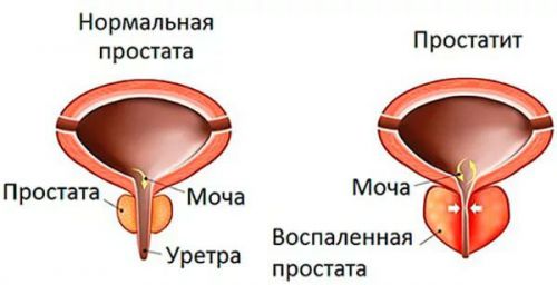 Моча: что это такое, ее показатели и физические свойства