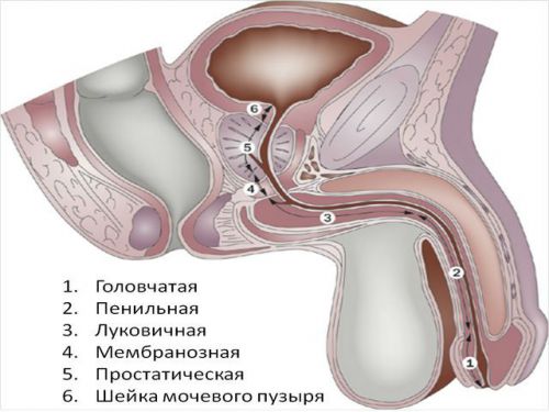 Катетер для мочи: классификация, техника выведения урины