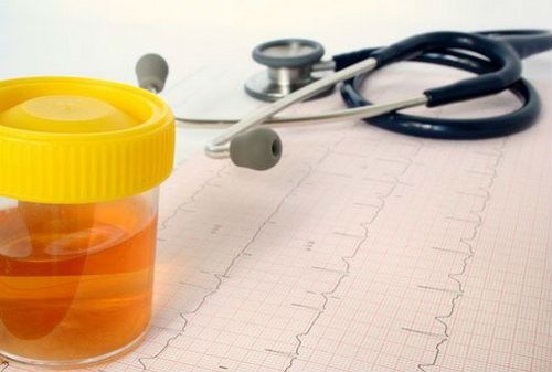 Оксалаты в моче: что означают соли и кристаллы кальция в анализе