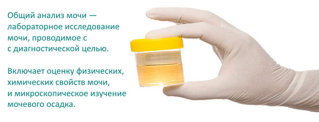 Как собрать мочу у грудничка-мальчика, правильно взять у новорожденного