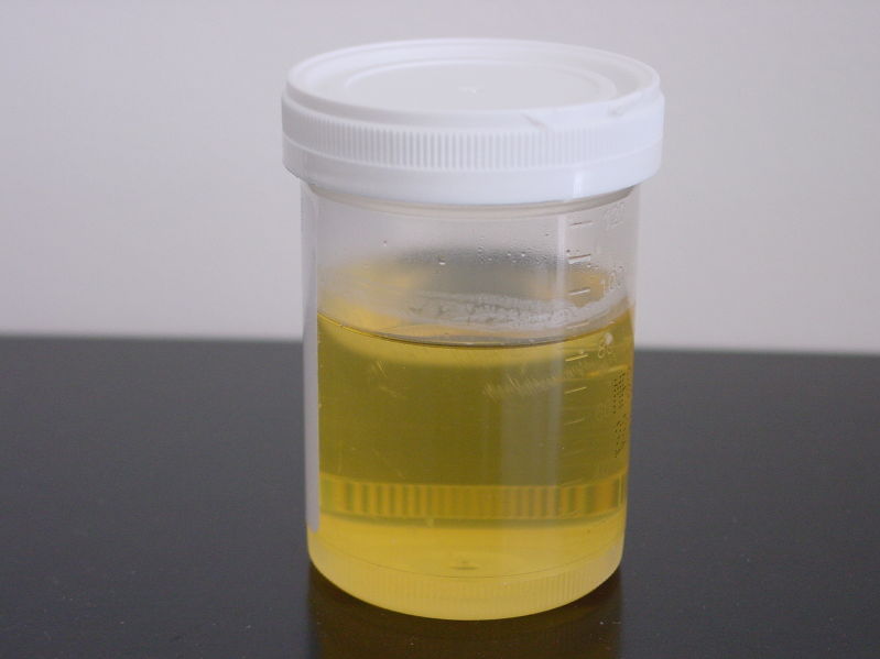 Кишечная палочка escherichia coli в моче: лечение антибиотиками, причины