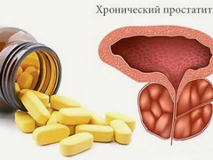 Таблетки от простатита: эффективные и дешевые препараты для лечения мужчин, отзывы