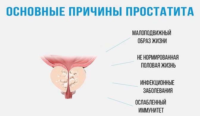 Можно ли вылечить хронический простатит навсегда: как лечить у мужчин, отзывы