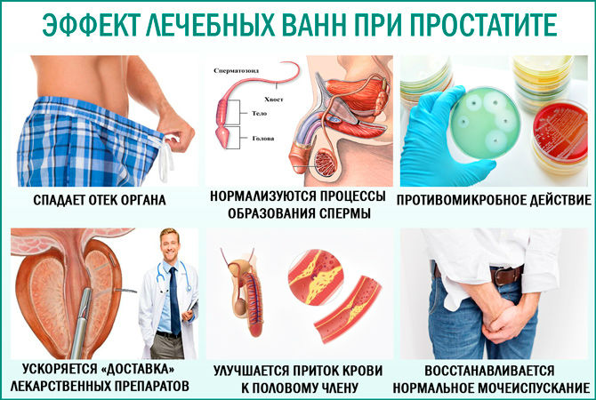 Можно ли греть простату при простатите, особенности прогревания