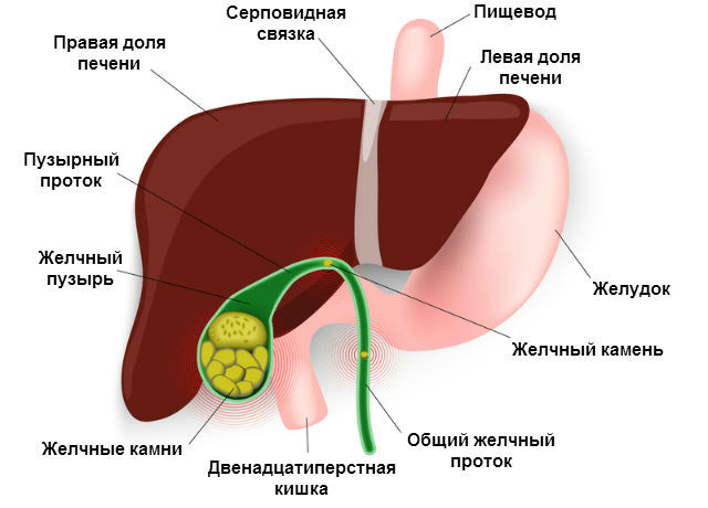 Дистанционная литотрипсия (ударно-волновая), отзывы