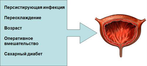 Лечение цистита у женщин: как быстро лечить болезнь, какими лекарствами