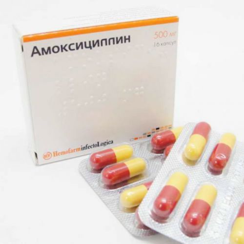 Что делать при цистите и его первых признаках, лечение обострений