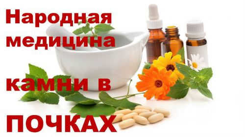 Лечение мочекаменной болезни народными средствами у женщин, популярные рецепты