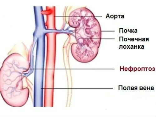 Диагностика болезней почек, основные симптомы заболеваний