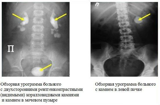 Диагностика болезней почек, основные симптомы заболеваний