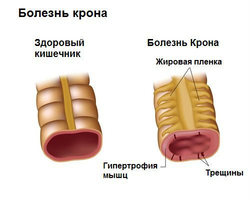 Липкая моча у ребенка, женщин и мужчин, норма ее показателей
