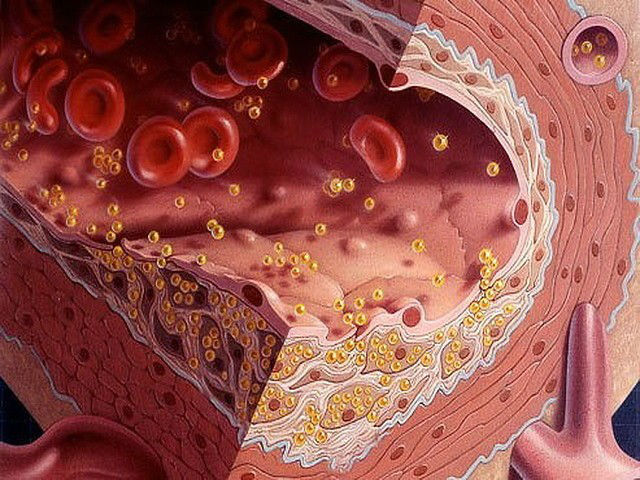 Жир в моче, причины жирных пятен у ребенка и взрослых Жир в моче, причины жирных пятен у ребенка и взрослых