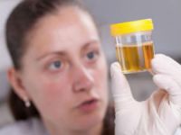 Жир в моче, причины жирных пятен у ребенка и взрослых Жир в моче, причины жирных пятен у ребенка и взрослых